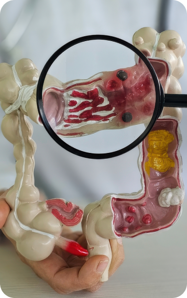 Bibiotic helps immuno care